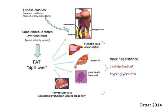 Ectopic Fat